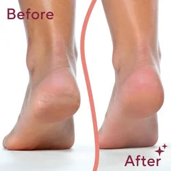 Pedi Roller With USB, Pedi Spin, Foot
Massager, Foot Cleaner